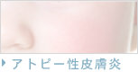 アトピー