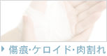 傷痕・ケロイド・肉割れ
