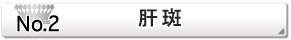 肝斑