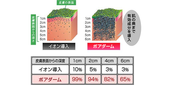 ポアダームとイオン導入の比較図