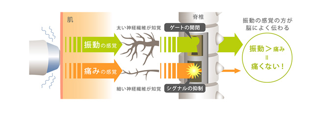 サーマクールのメカニズム
