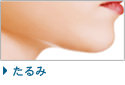 たるみ治療