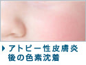 ポアダーム