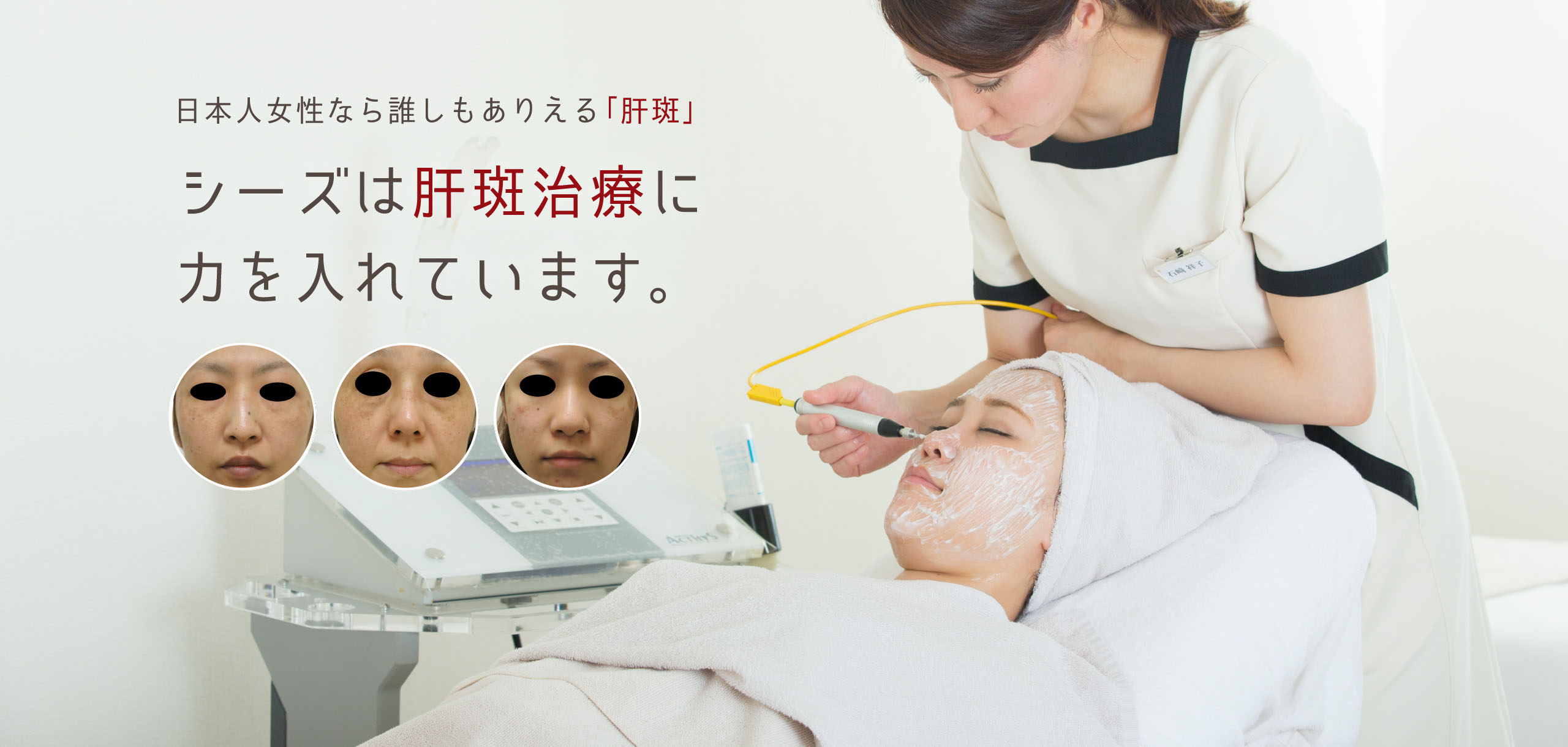 日本人女性なら誰しもありえる「肝斑」シーズは肝斑治療に力を入れています。